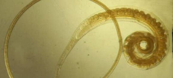 Tricocefali