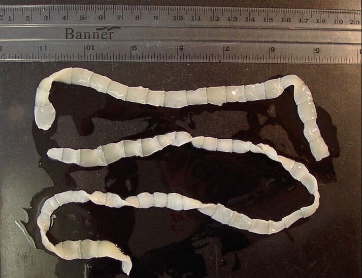 Tenia che vive nell'intestino tenue umano