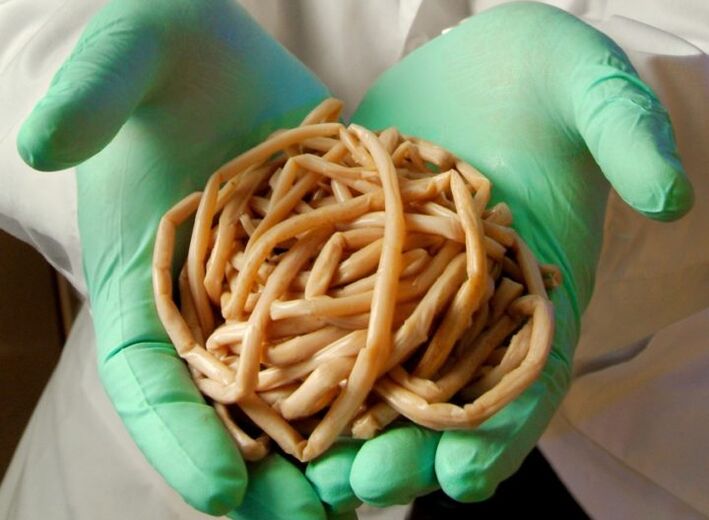Verme parassita lungo nelle mani di un medico